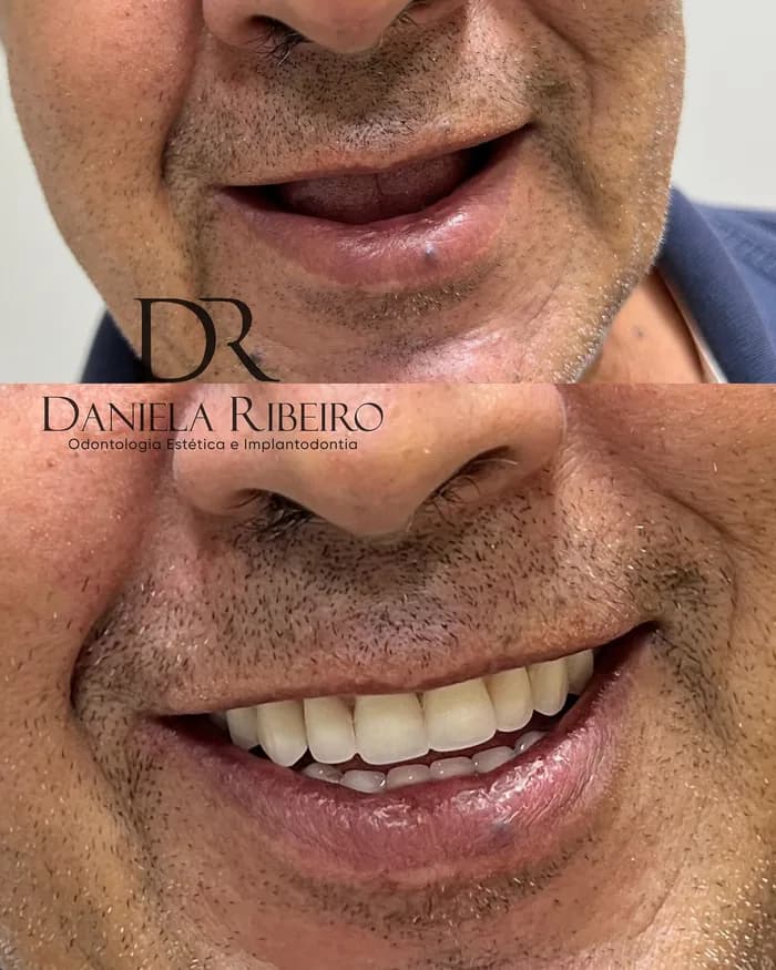 Antes e depois — Dra. Daniela Ribeiro 2