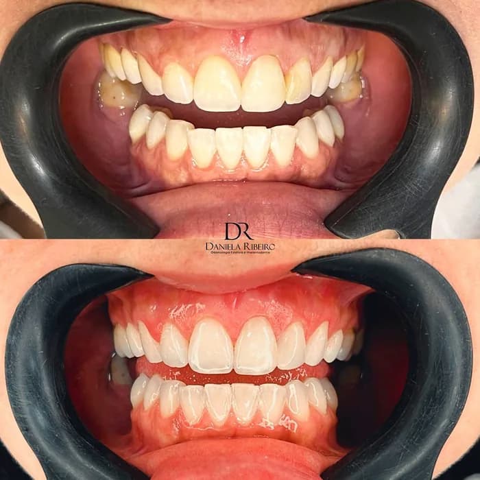 Antes e depois — Dra. Daniela Ribeiro 3