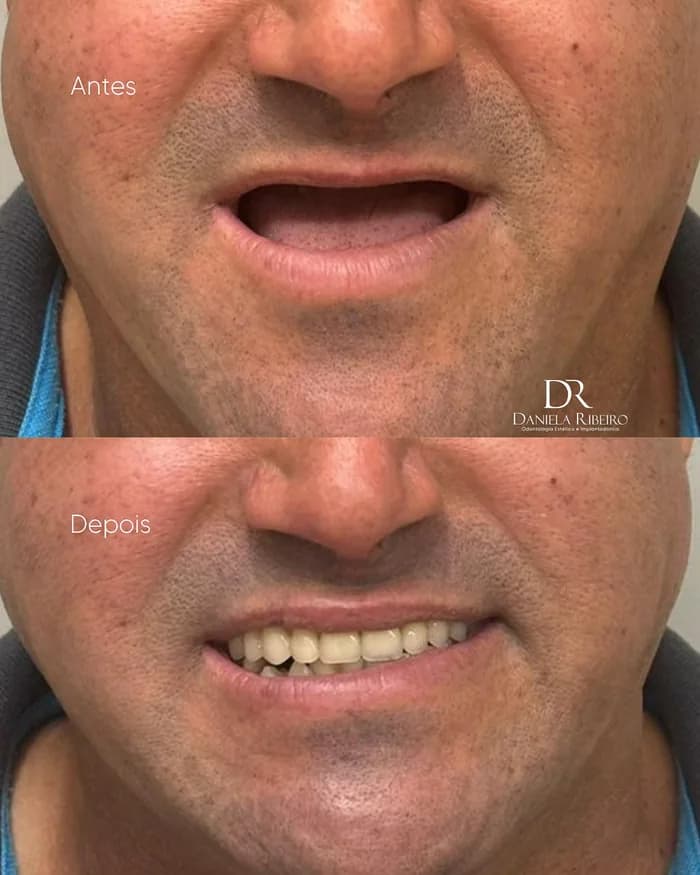 Antes e depois — Dra. Daniela Ribeiro 5