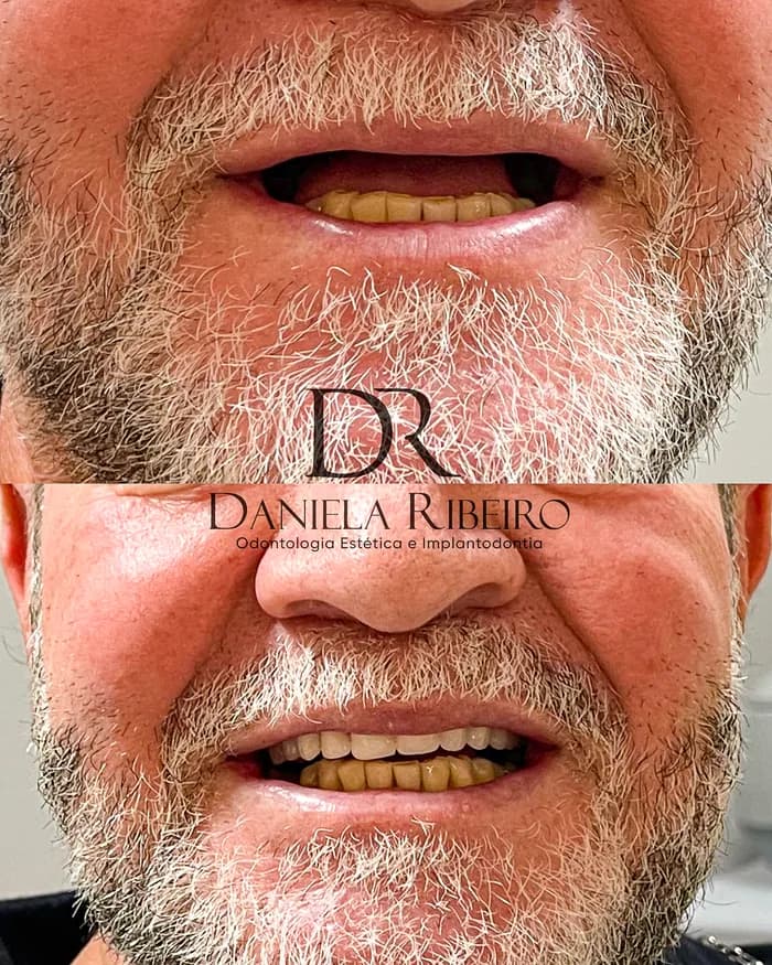 Antes e depois — Dra. Daniela Ribeiro 8