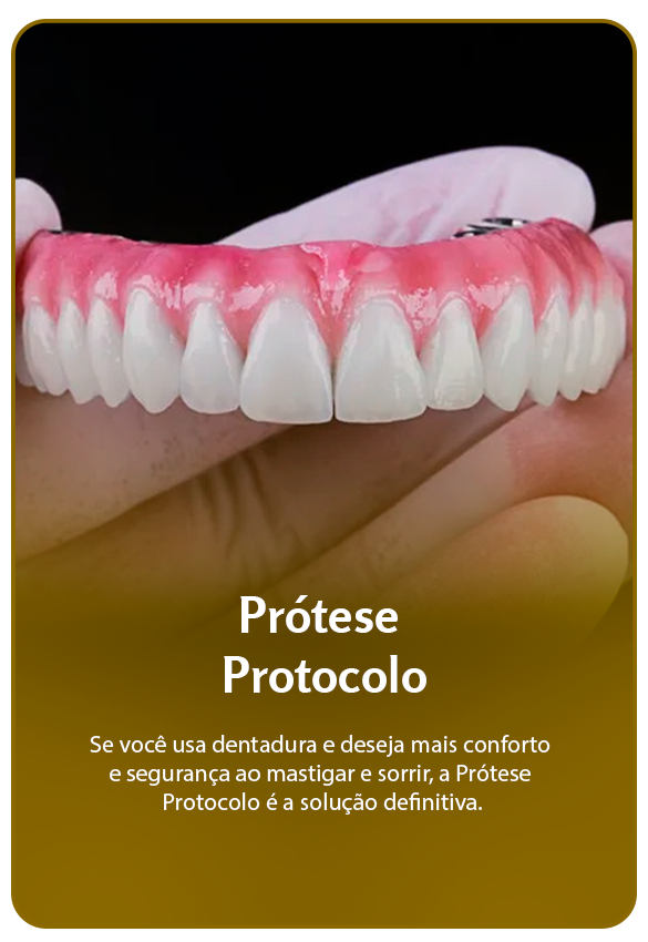 Prancheta 3